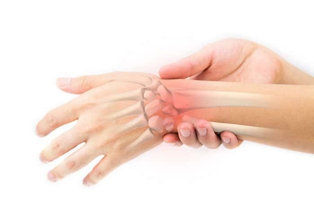 A human hand showing the Reflex Sympathetic Dystrophy Syndrome illustration