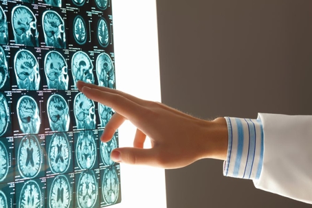 doctor examining brain scans